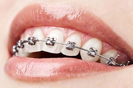 Best Dentist In Aundh Pune Best Dentist In Aundh Pune