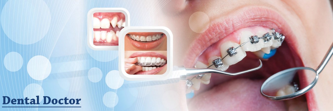 Dental Doctor In Aundh Pune Dental Doctor In Aundh Pune