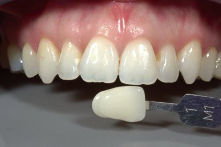 Dental Doctor In Aundh Pune Dental Doctor In Aundh Pune